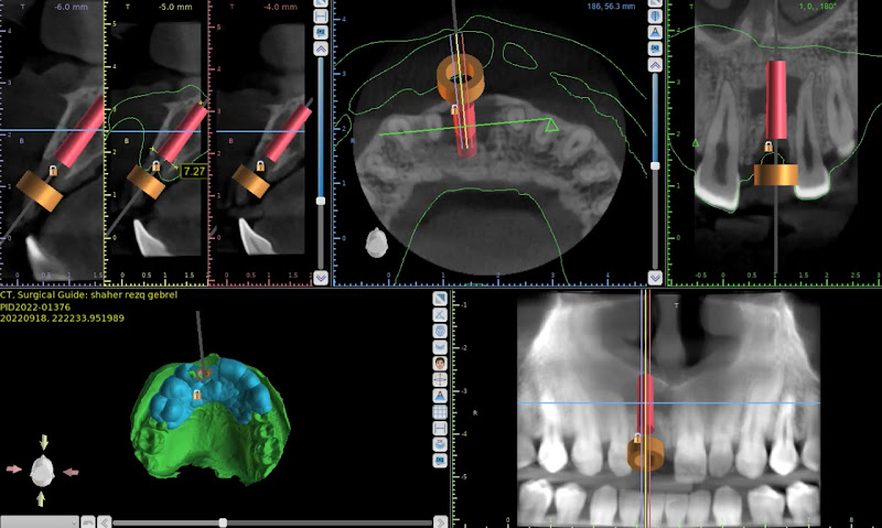 Al-Basma Scan for Dental Digital Solutions – Al-Basma Scan Center for Dental X-rays