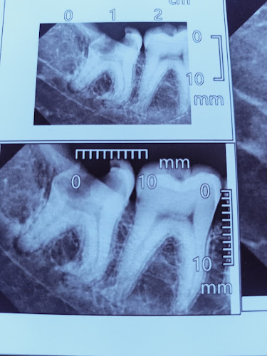 Dr. Osama Abozeid Dental Center