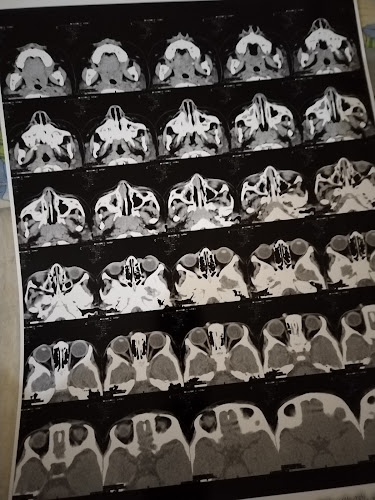 Mansoura Scan for Radiology, Prof. Dr. Magdy El-Rakhawy