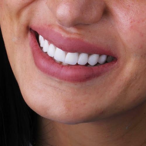 Dr. Osama Abuzaid Center for Cosmetic and Implant Dentistry (Saudi Clinic)