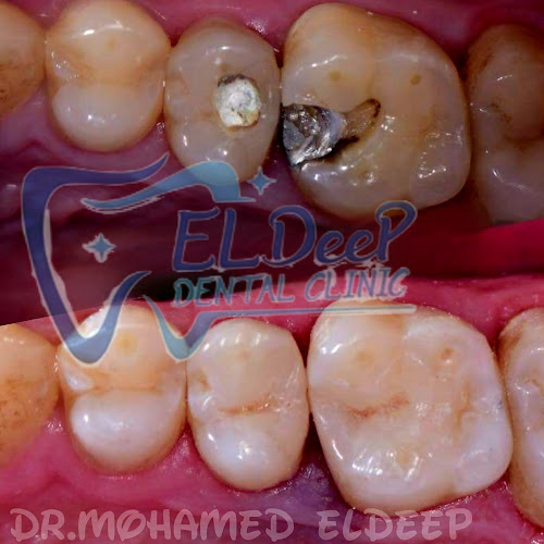 Eldeep Dental Clinic, Dr. Mohamed Waheed Eldeep
