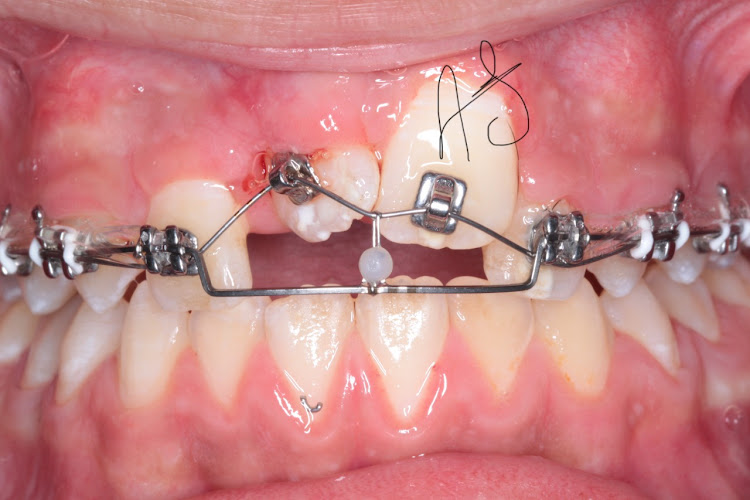 Dr. Ahmed Salah El-Toukhy’s Orthodontic Clinic