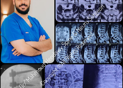 AHVAweqyiUB2SILDSHdPpn4RDPAbCjB4s8DSdtnEi73xEjXkdu3RVHlzQmK0yVib9pwuH_3IGnXM5zMVTOk3SrLDBNiuJe3ygGoUnI7Gt2JZRsAaWW5H55-fl8_4BnHG5swHGcN1BK2Kw800-h500-k-no-1.jpg
