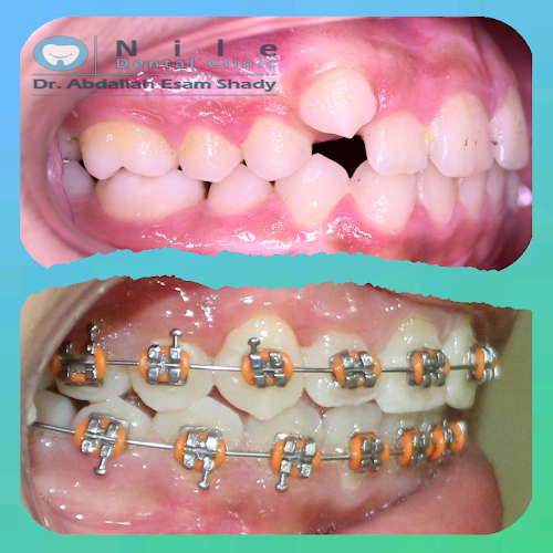 Dr. Abdullah Essam Shadi – Specialist in Oral Surgery and Dental Implants
