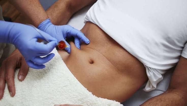 Dr. Sarah Ahmed Al-Kharasa Center for Physiotherapy, Obesity, Weight Loss, and Fat Deposits