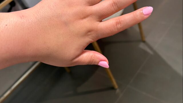 Google Photo 2