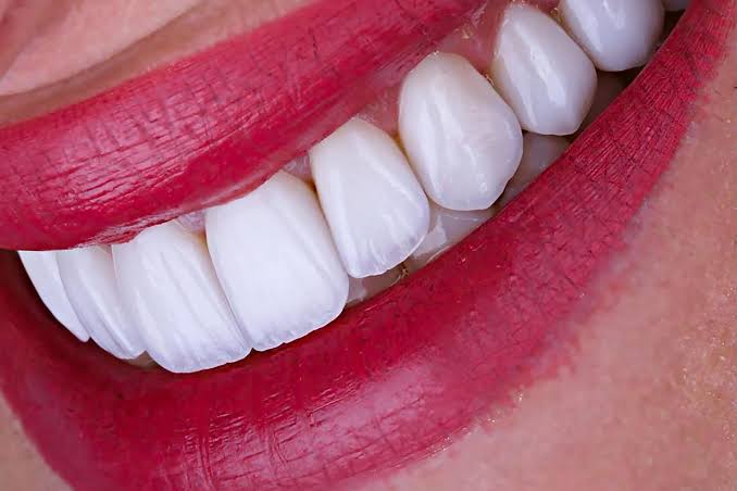 عيادة د. أسامة عامر لتجميل وزراعة الأسنان – عيادة الدكتور أسامة عامر لطب الأسنان