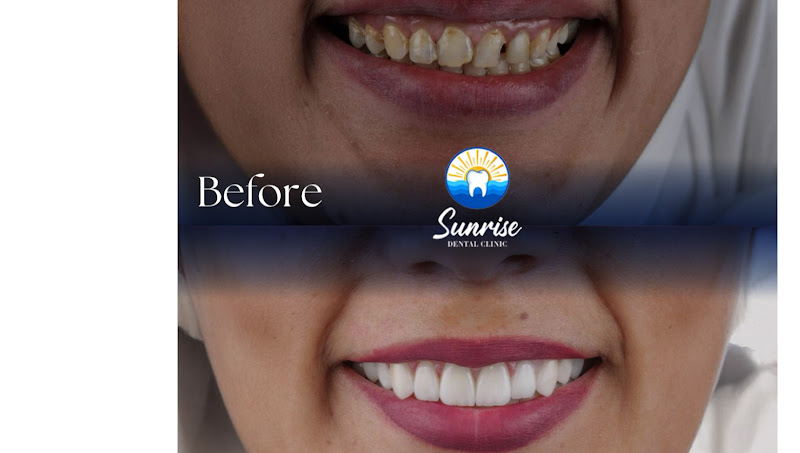 Sunrise Dental Clinic Cairo