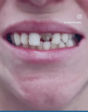 ACvplmPX6zSle9pULTvdHrtrkmObgc6LYJbtoA2x02T6lbtq-N99jPzjIt48QEabZkeA8DIBkXH16EmEyjzHTBQ4AkShDpGMCDSahastPz2fB17khcB51N2Nw-IGO4D6mRvIFy2Yq1o2w800-h500-k-no-1.jpg