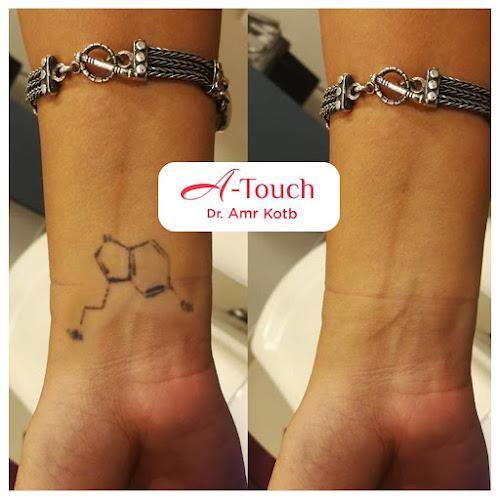 A-Touch Clinics Dr. Amr Kotb