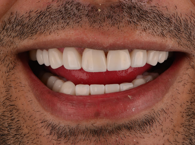Glow dental clinic Dr Amr El Seleimy
