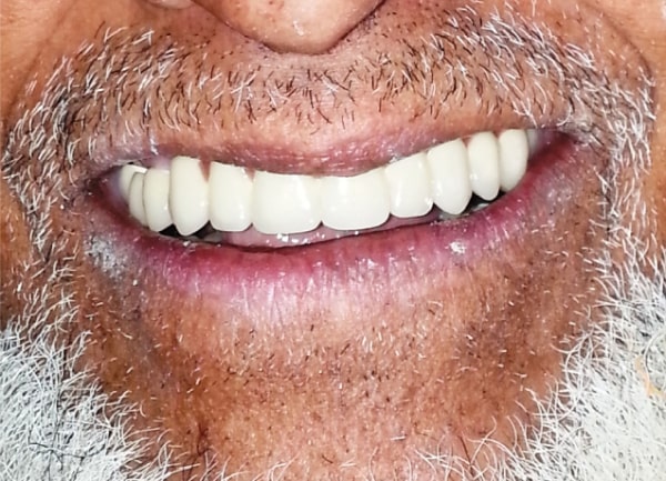 Bright Smile Dental Center
