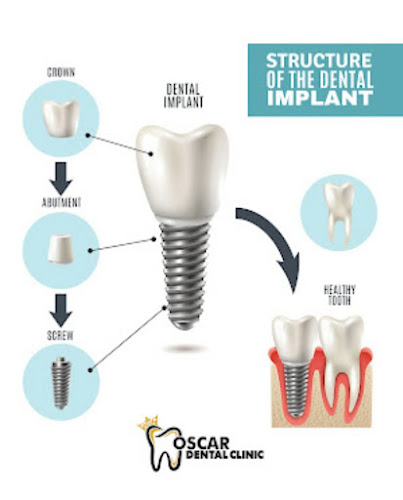 Oscar Dental Clinic