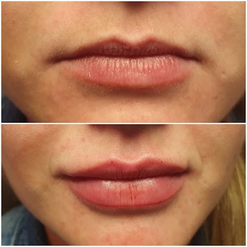 Androderma Laser Clinic