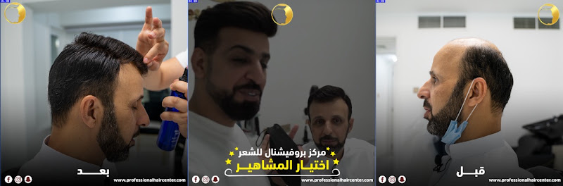 مركز متخصص في إصلاح الشعر