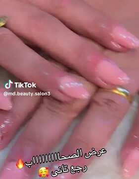 ANWiy9TXx0RvDxoufqigVwLPNvyxoTIvRUttfv8MJD2k4MxKFLPXusOwKcGhbjKDQJO9SmtVlvH4C34OzVN1Nr80yIZ_JalUHNHaOyl6Crm11QYy7rBy-9-z7B8Tf-QiKSzq-BsQ1cW4jq6p816Ww800-h500-k-no.jpg
